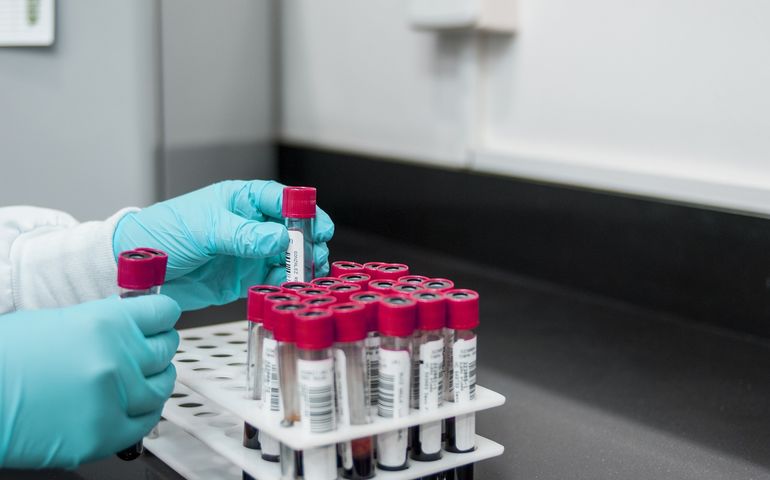 gloved hand with vials of blood 