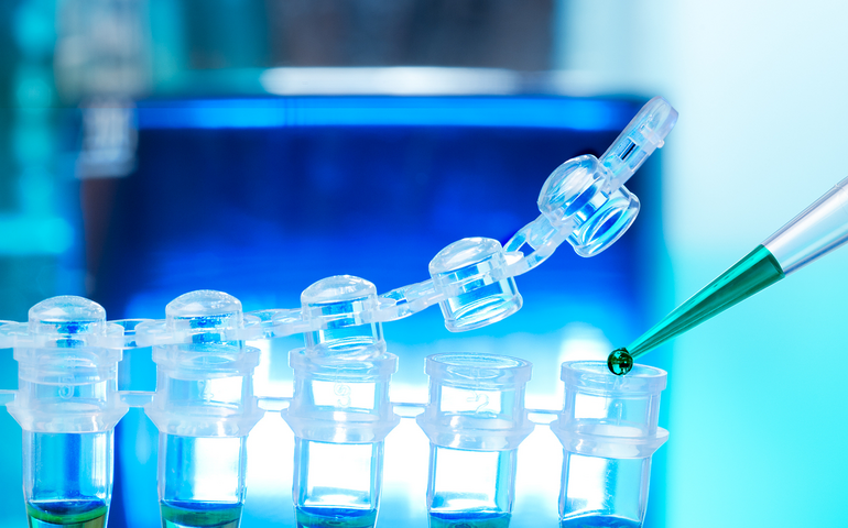 Beakers in lab 